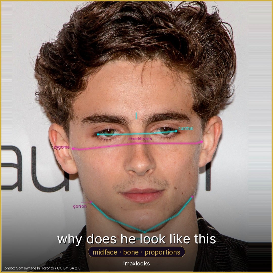Timothée Chalamet — why does he look like this