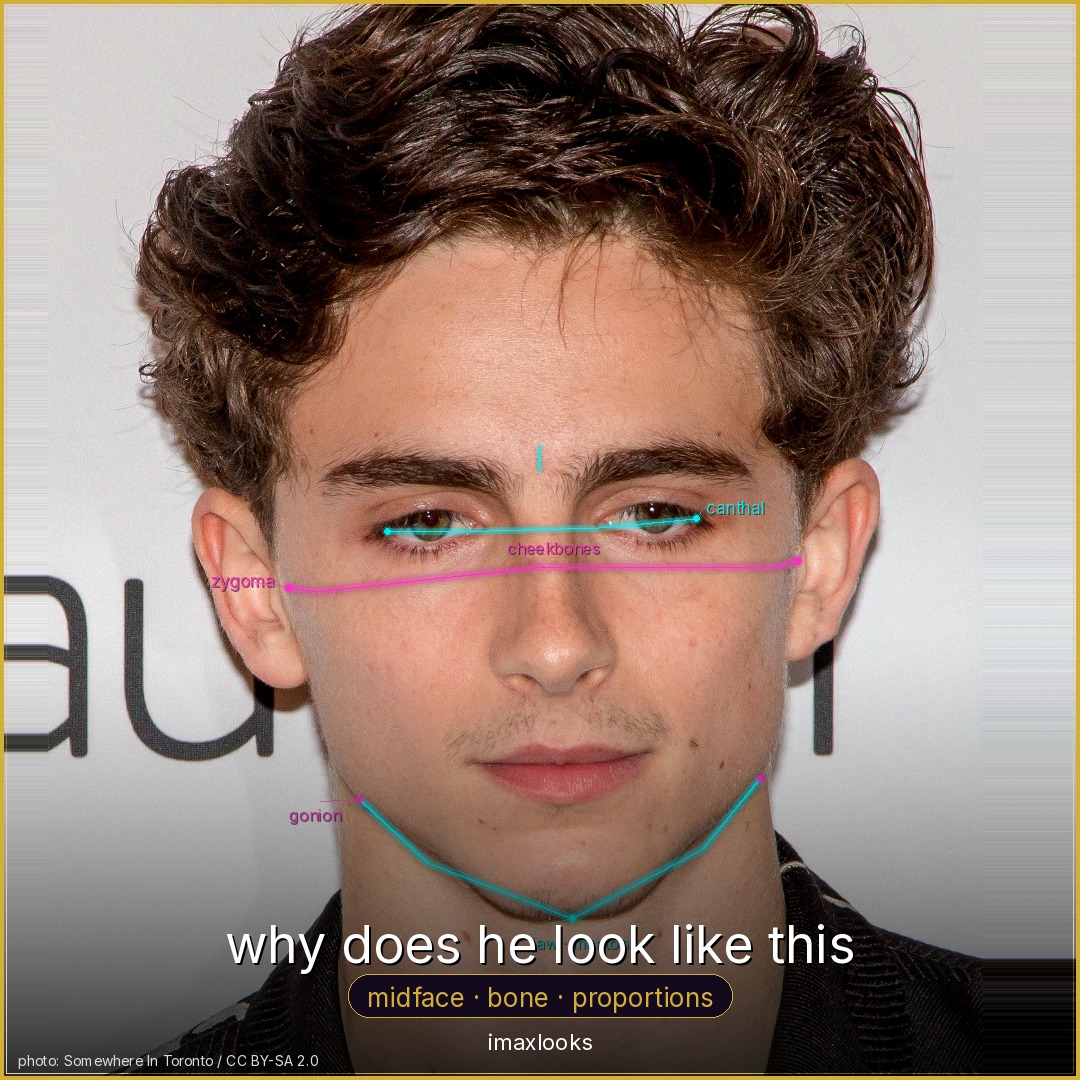 Timothée Chalamet — why does he look like this · midface · bone · proportions